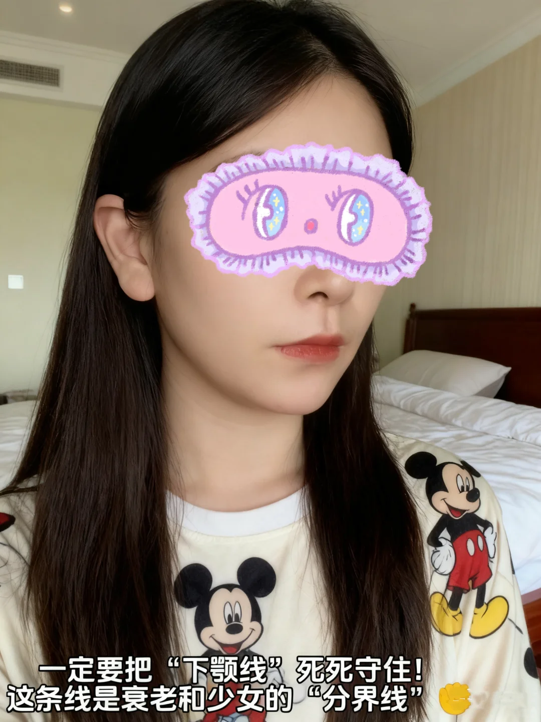 我也用上孟子义同款V脸绷带了‼️脸小到翻出