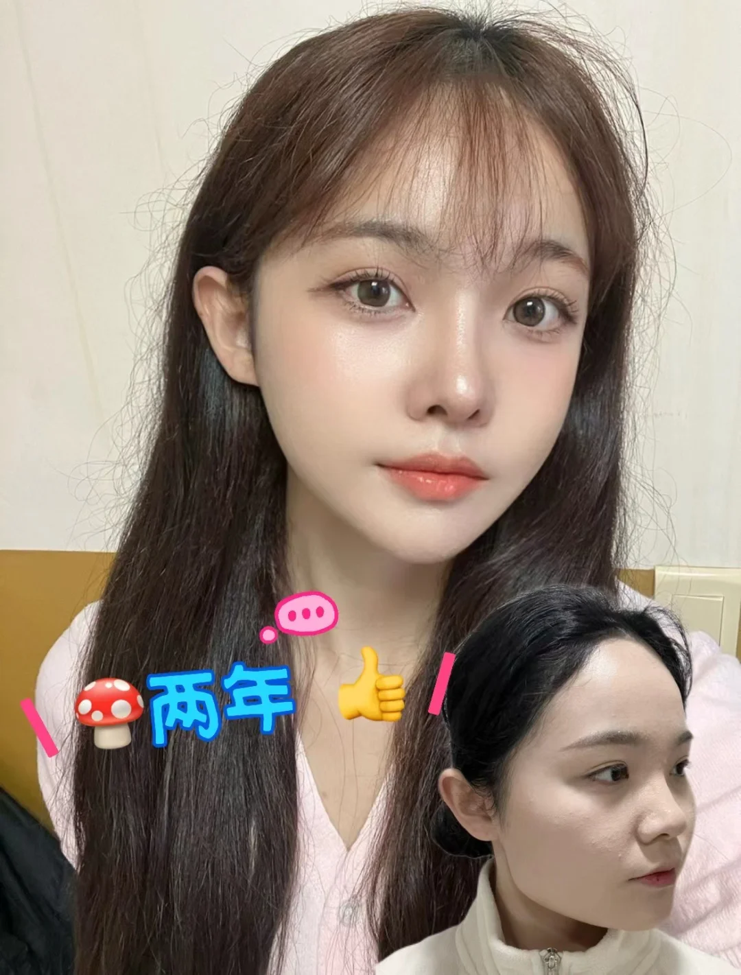 两年了，最开心的是拍照不用P脸型了！