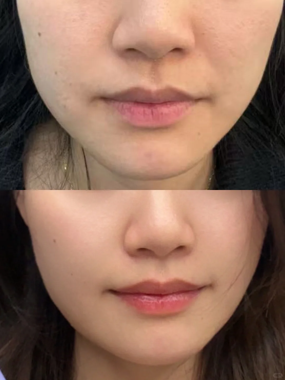 这个月我成功把头皮和脸一起养好了！✨