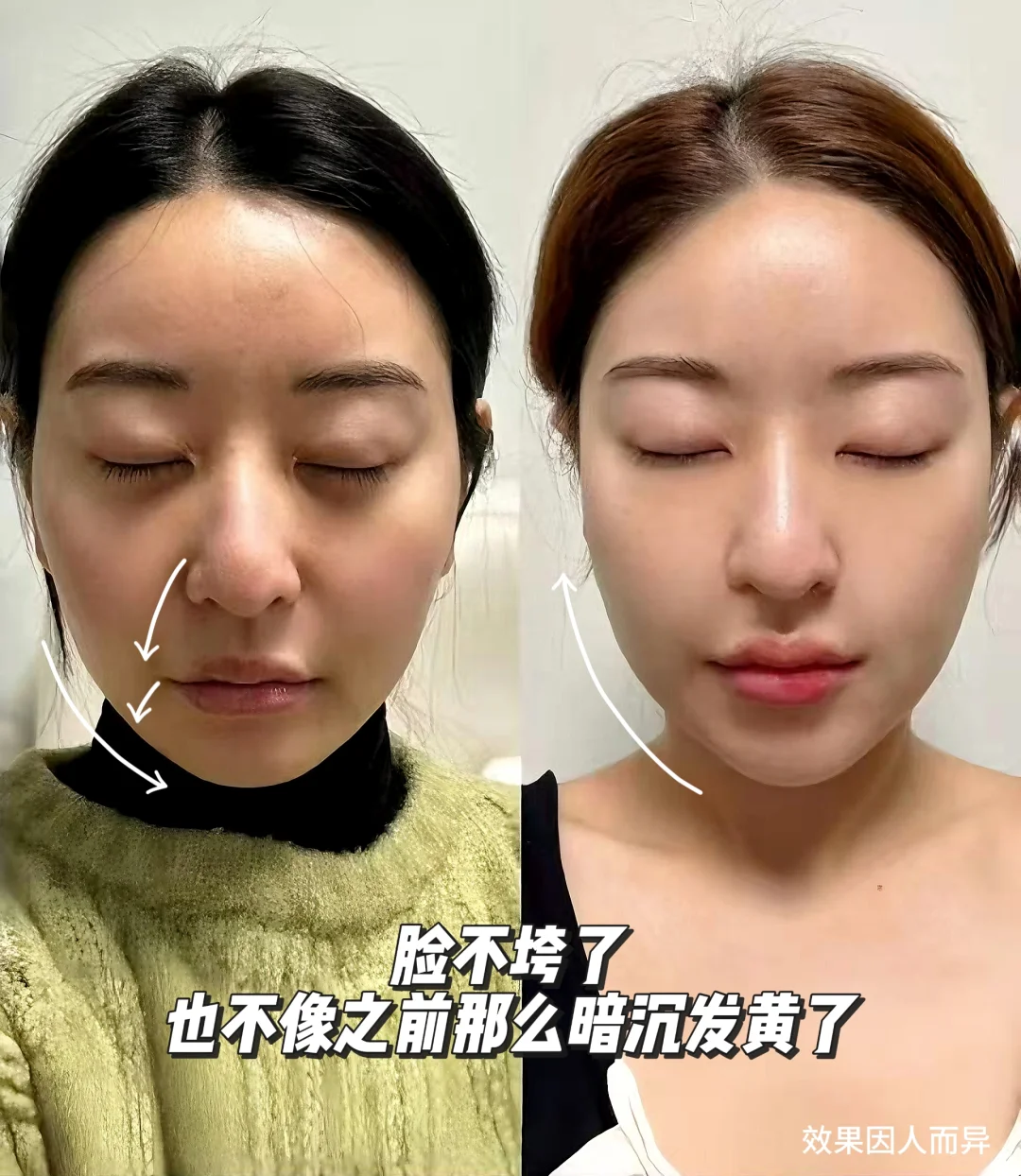 当我问DeepSeek美容仪咋选？它说…