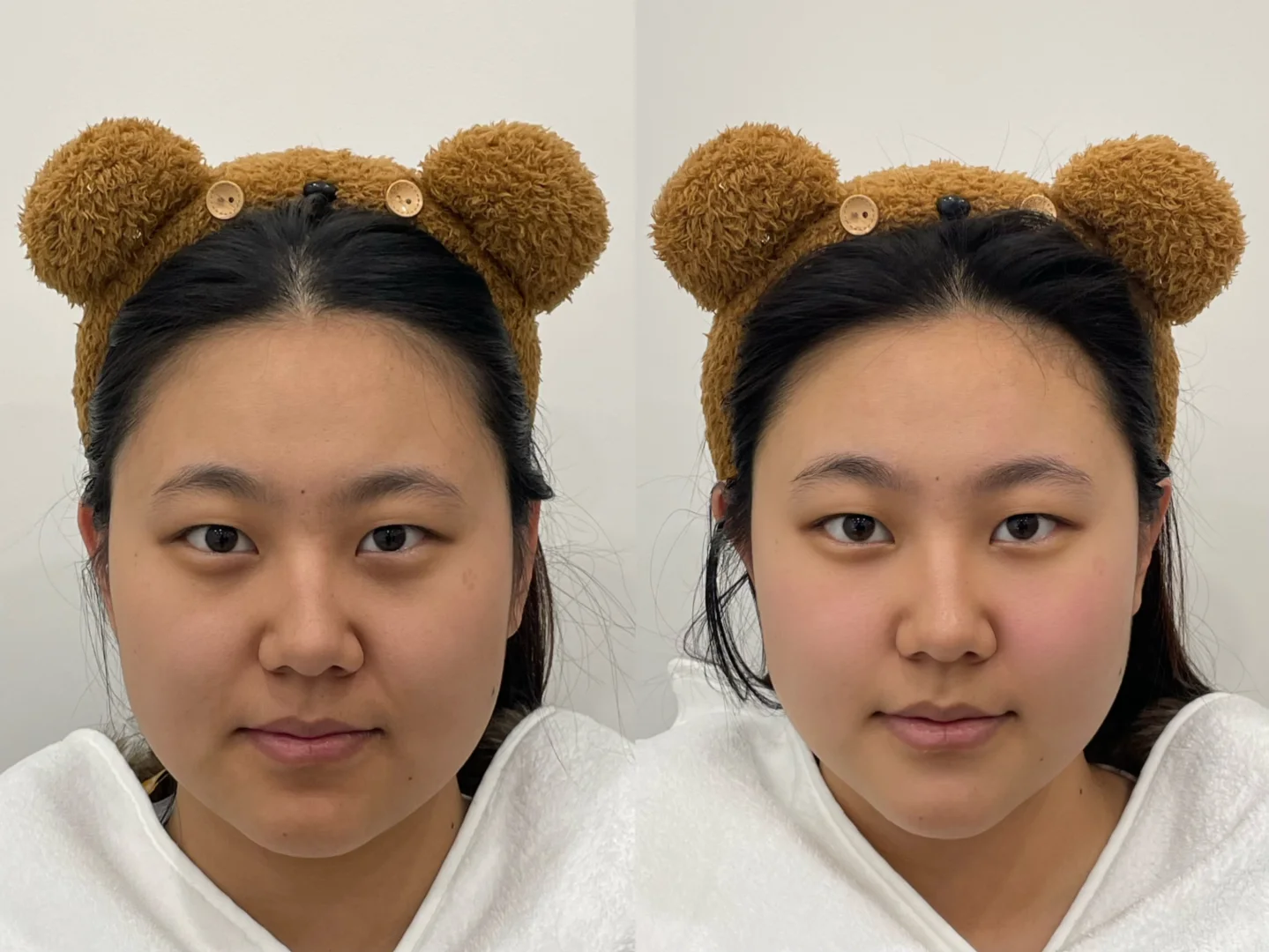 方圆脸变美小秘籍📖没事儿来捏捏脸