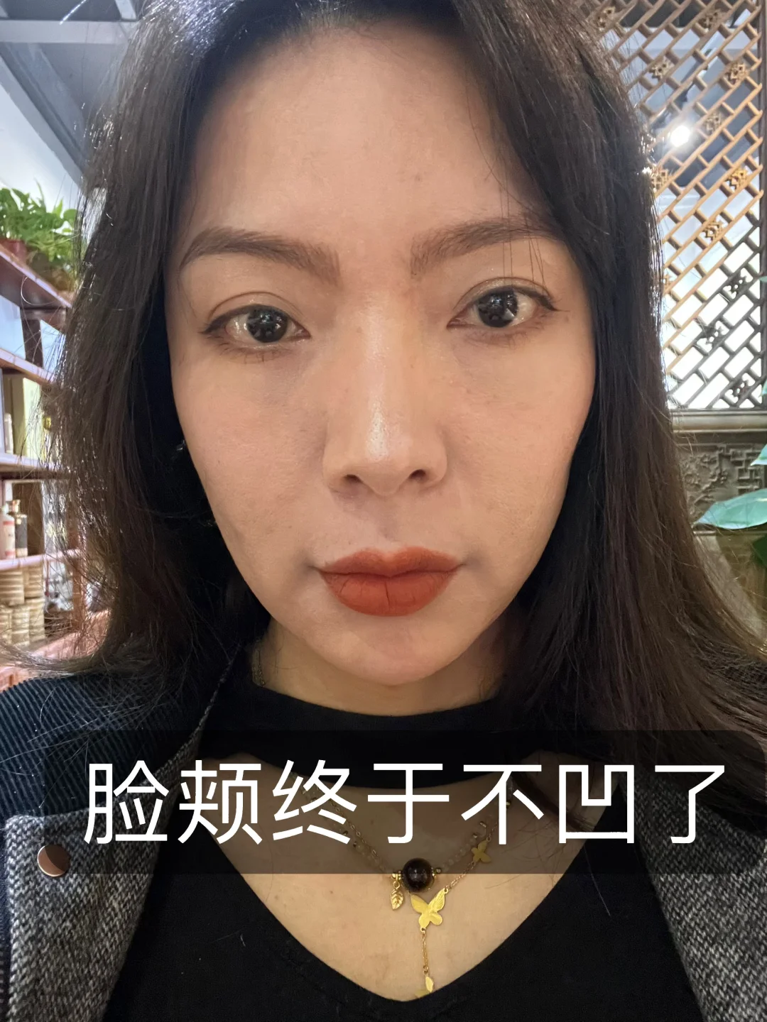 即将四十了，脸颊终于不凹了