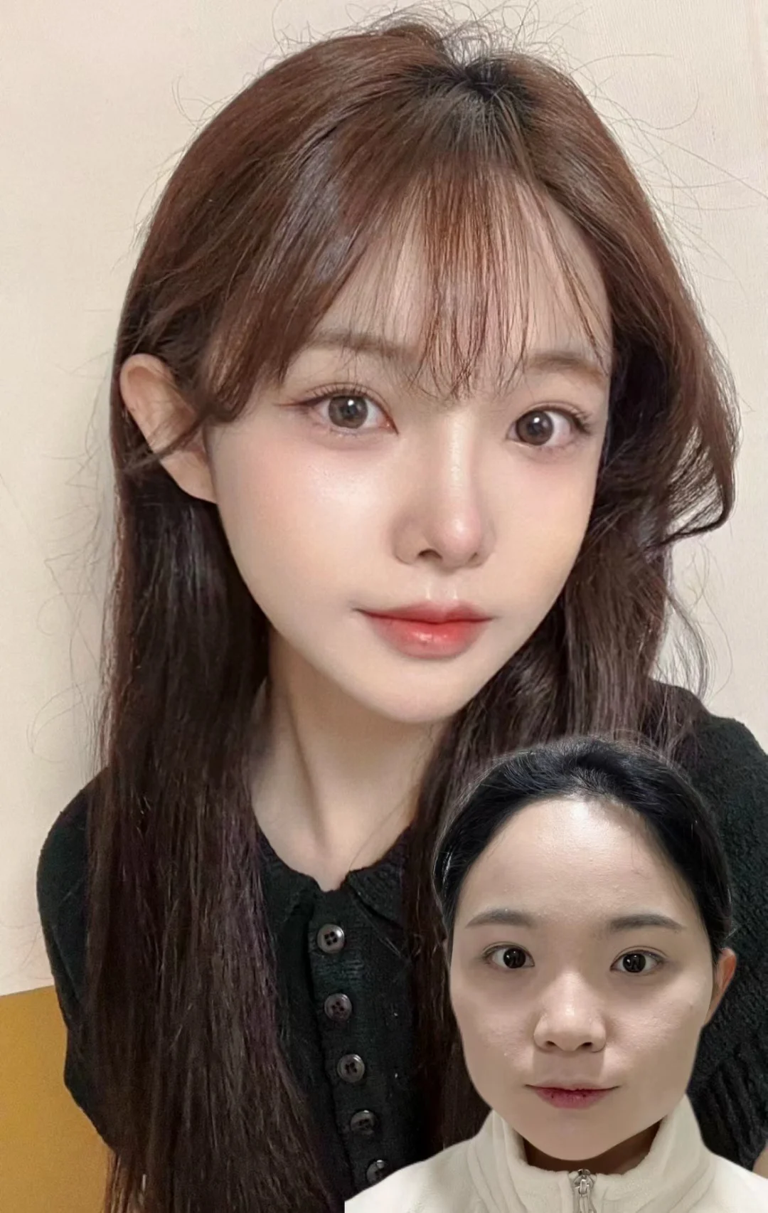 两年了，最开心的是拍照不用P脸型了！