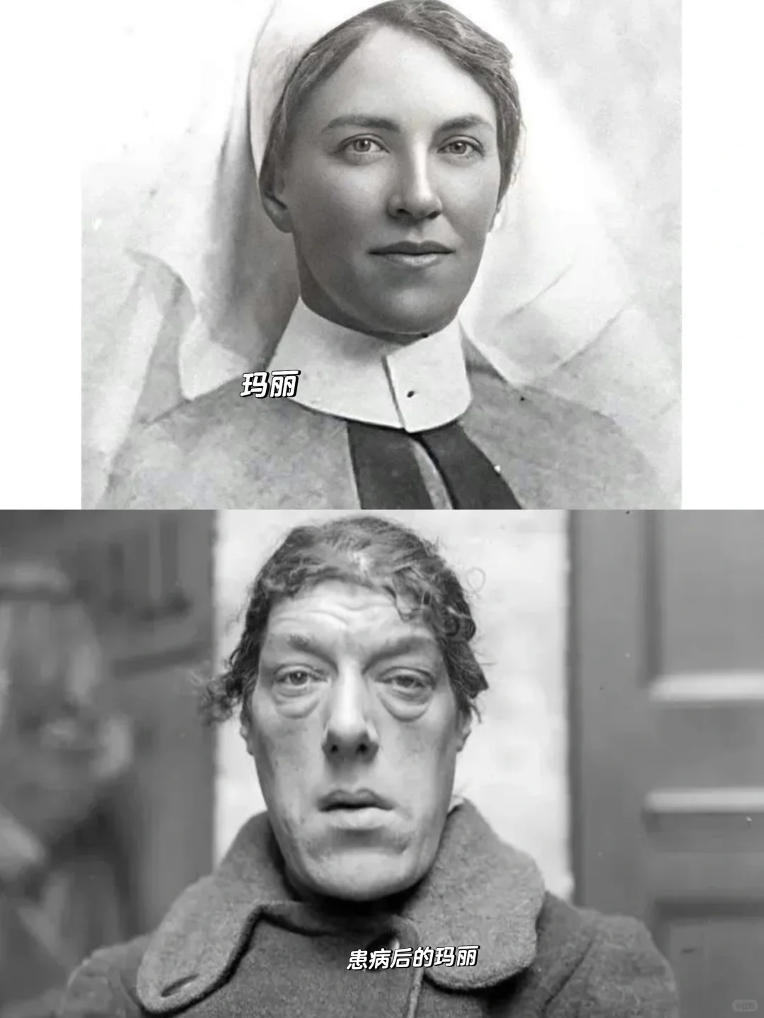 一个世界蕞丑的女人，一位内心蕞坚韧的母亲