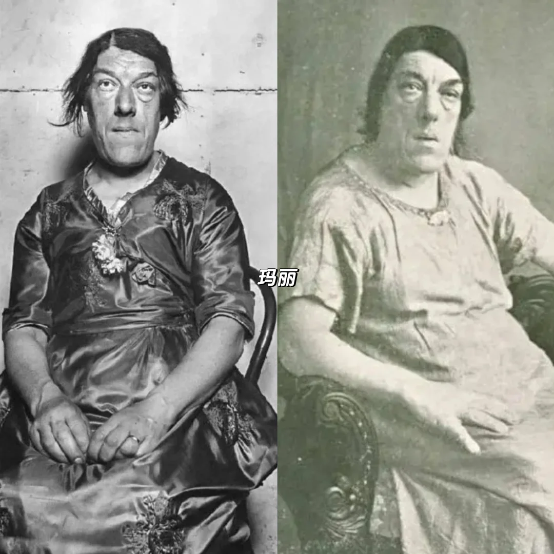 一个世界蕞丑的女人，一位内心蕞坚韧的母亲