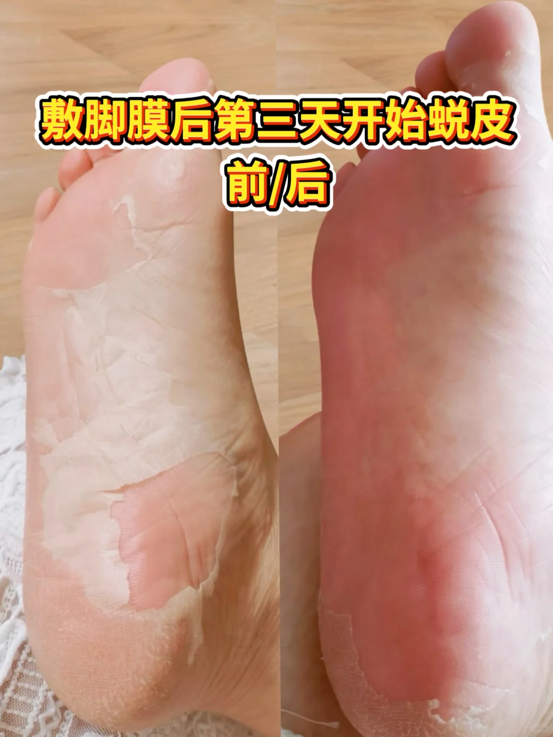 很惊喜😍发现了养出嫩白jiojio🦶的方法