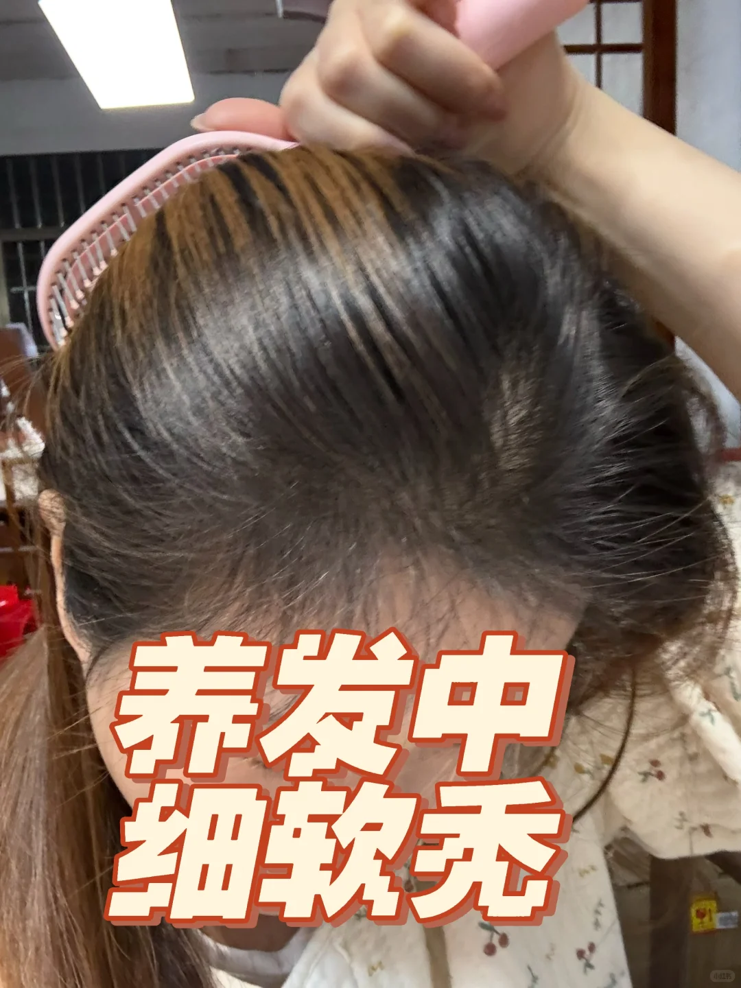 意外之喜，居然长了这么多头发