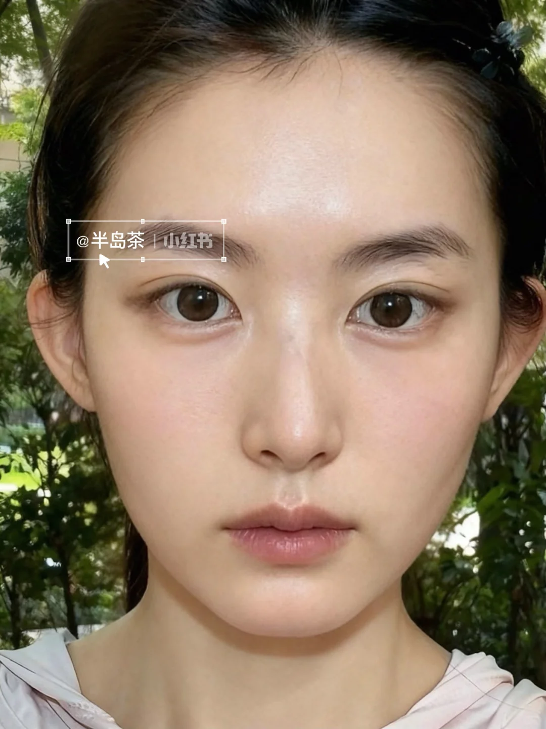 33岁一针打飞眼尾，朋友问我到底经历了什么～