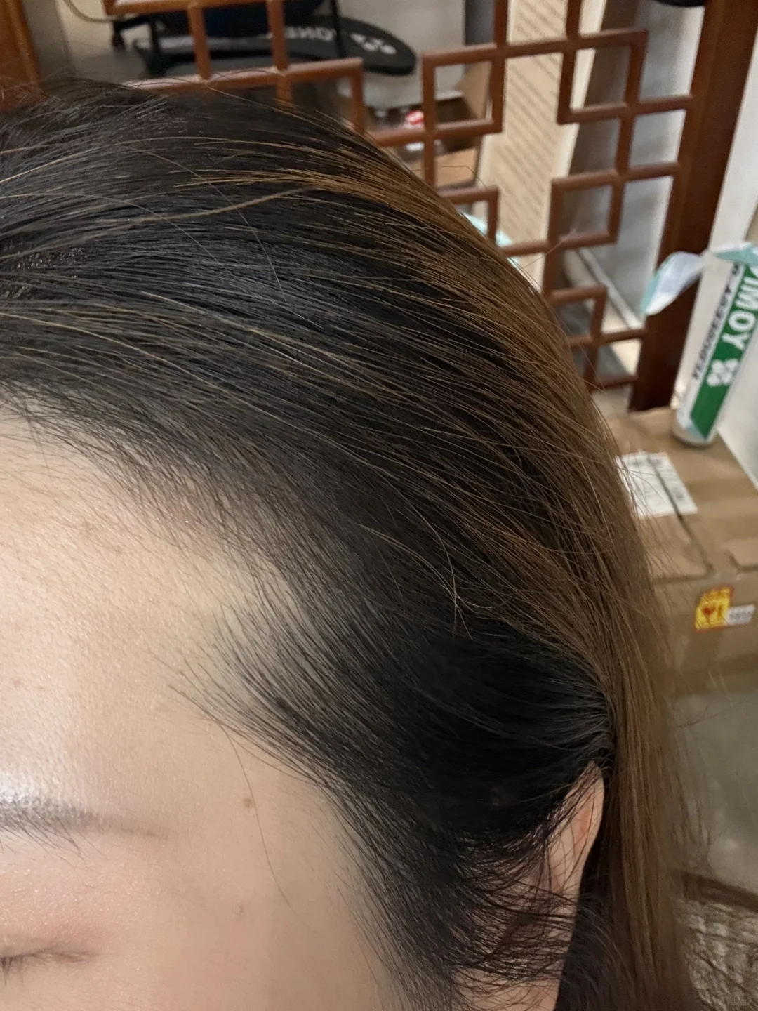 意外之喜，居然长了这么多头发