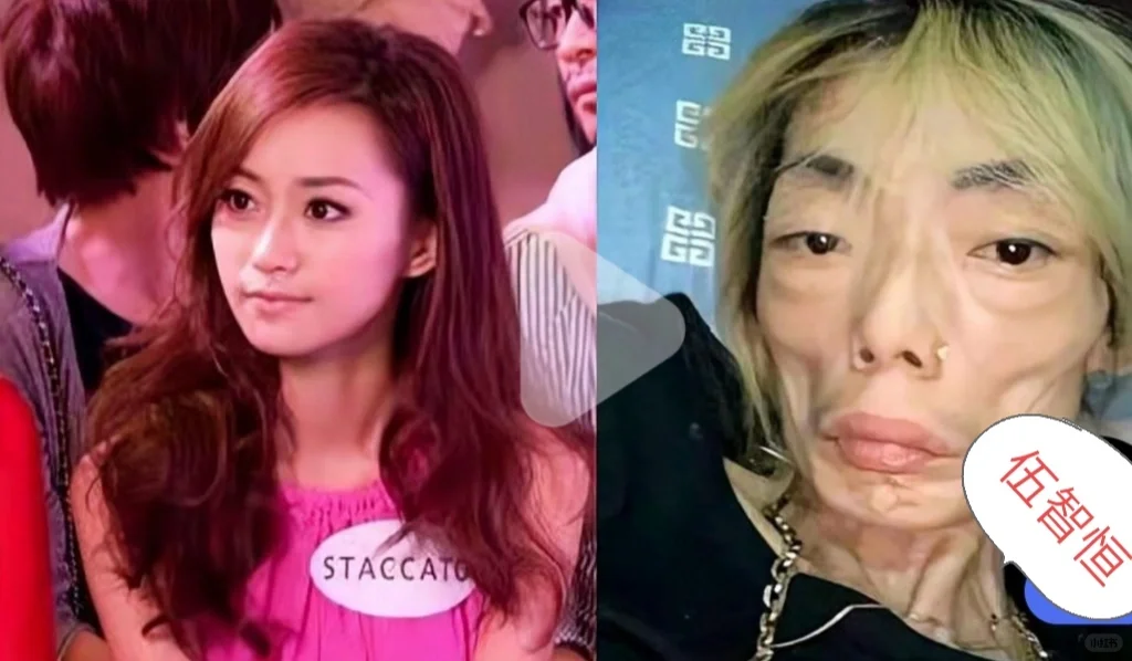 8年的豪门婚姻嫩模变“骷髅”
