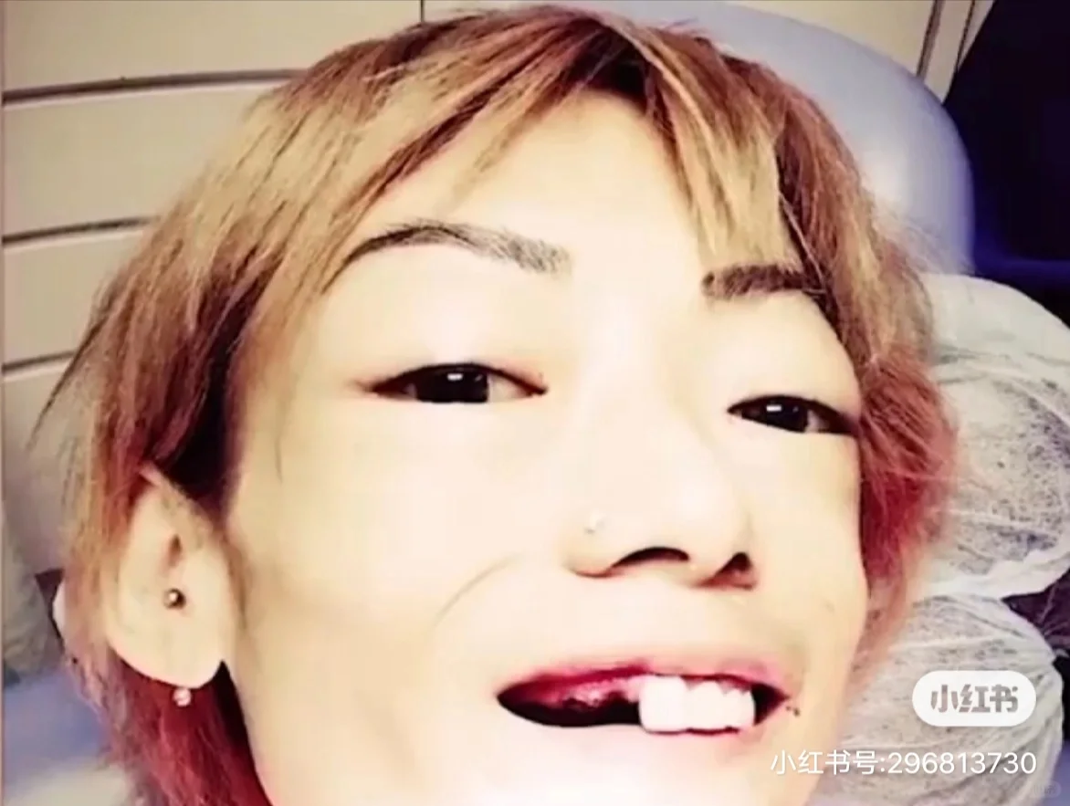 8年的豪门婚姻嫩模变“骷髅”