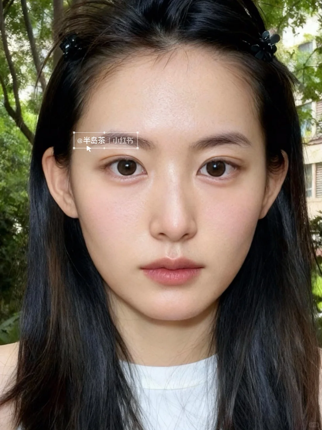 33岁一针打飞眼尾，朋友问我到底经历了什么～