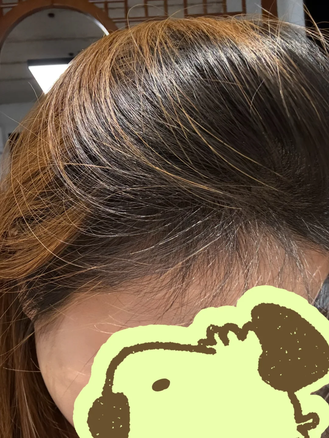 意外之喜，居然长了这么多头发