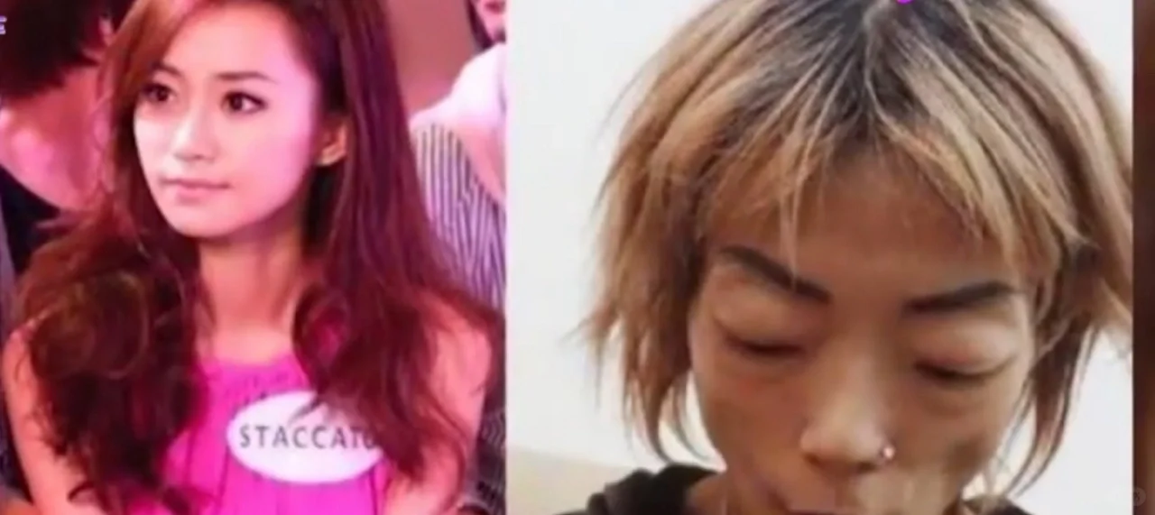 8年的豪门婚姻嫩模变“骷髅”