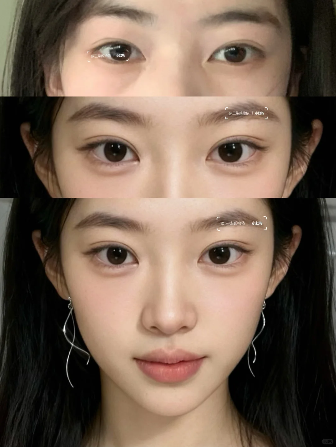 尝试一针打飞眼尾没想到面相都变了～