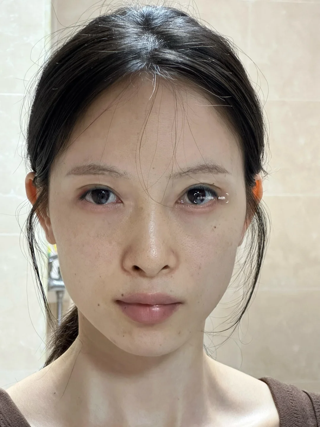 打了一针上扬的不仅仅是眼尾！脸都提起来了