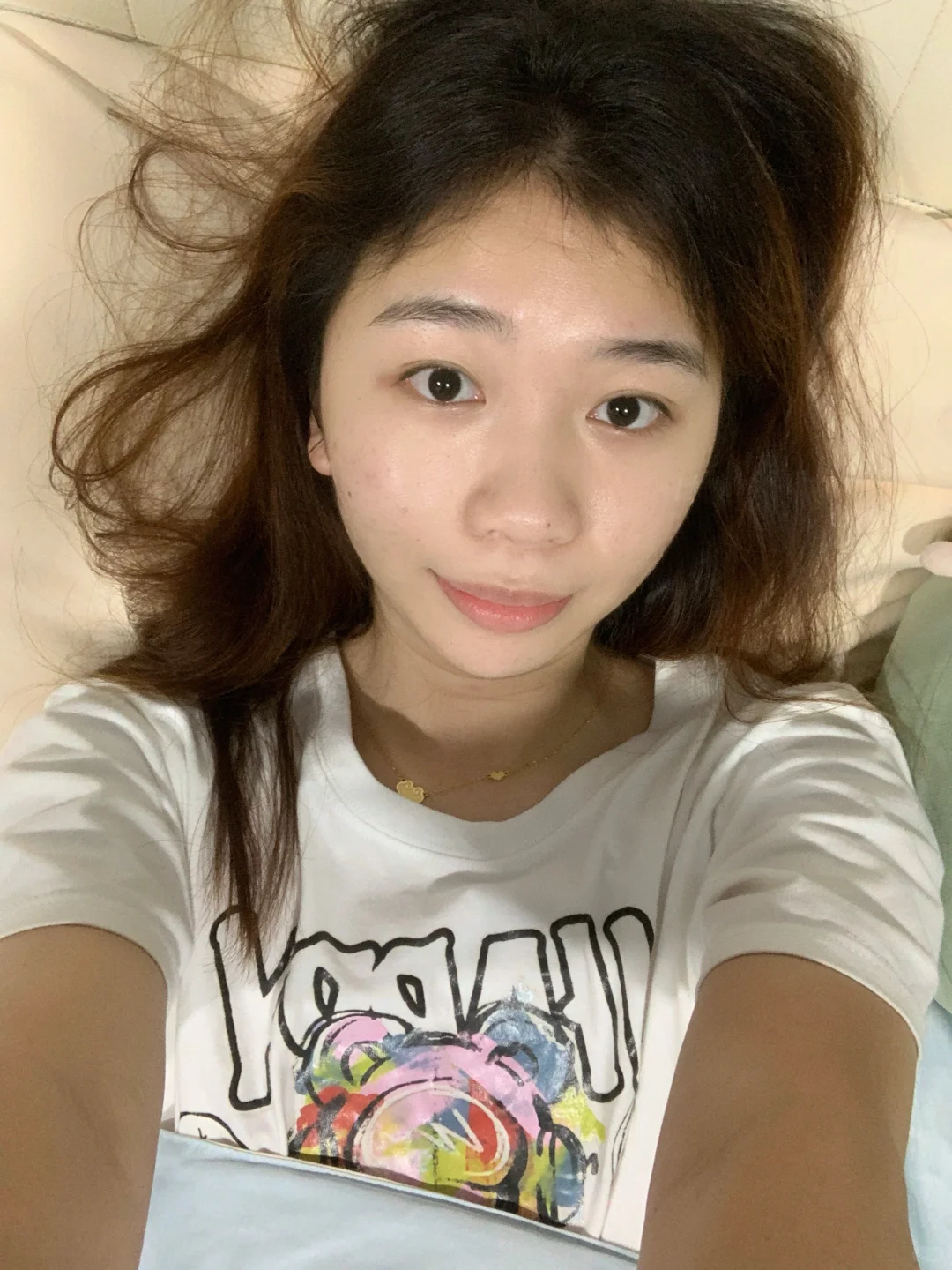 皮肤真的肉眼可见的变好了