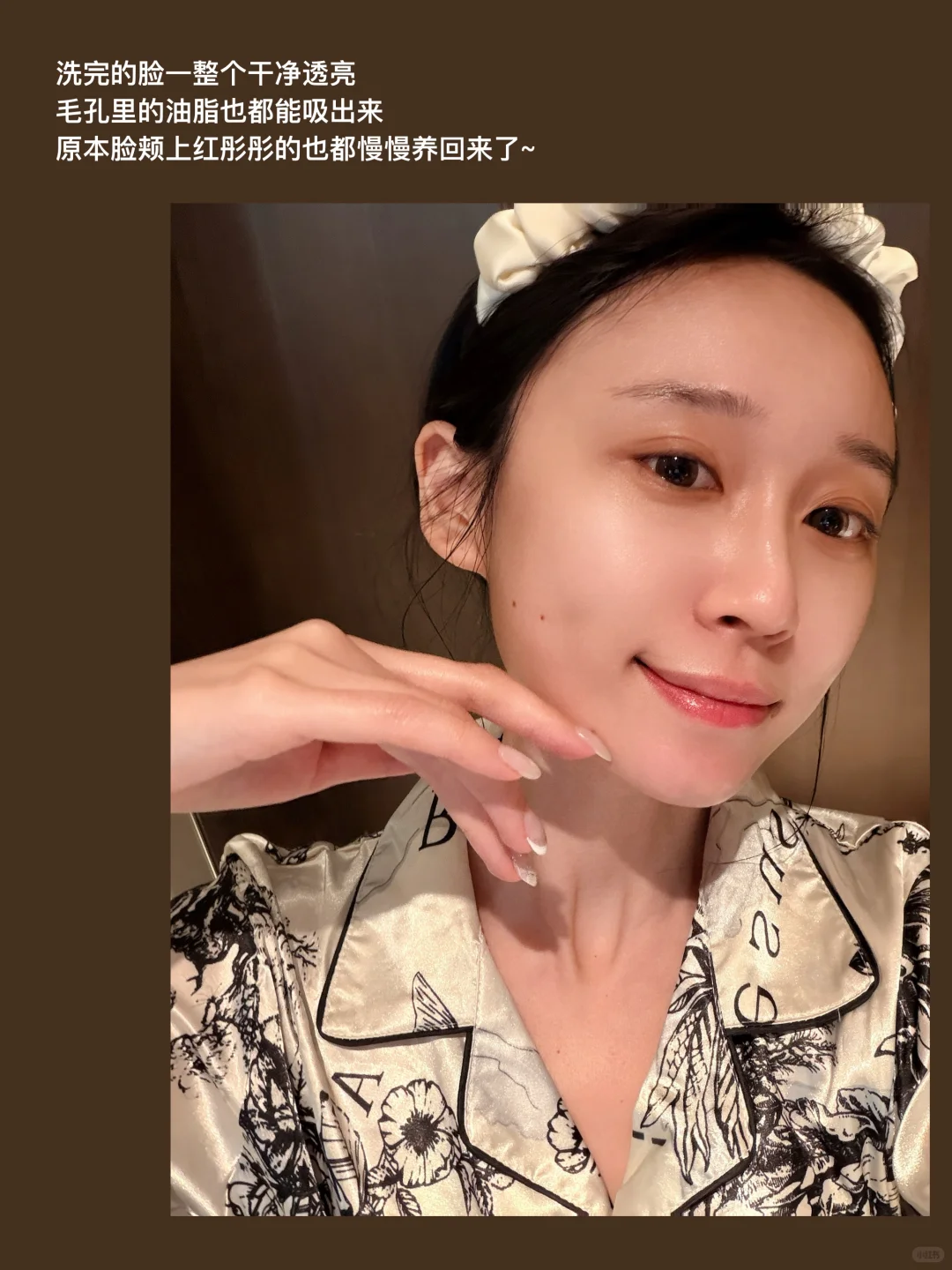 秋冬护肤爱用丨我的脆皮敏感肌养护心得