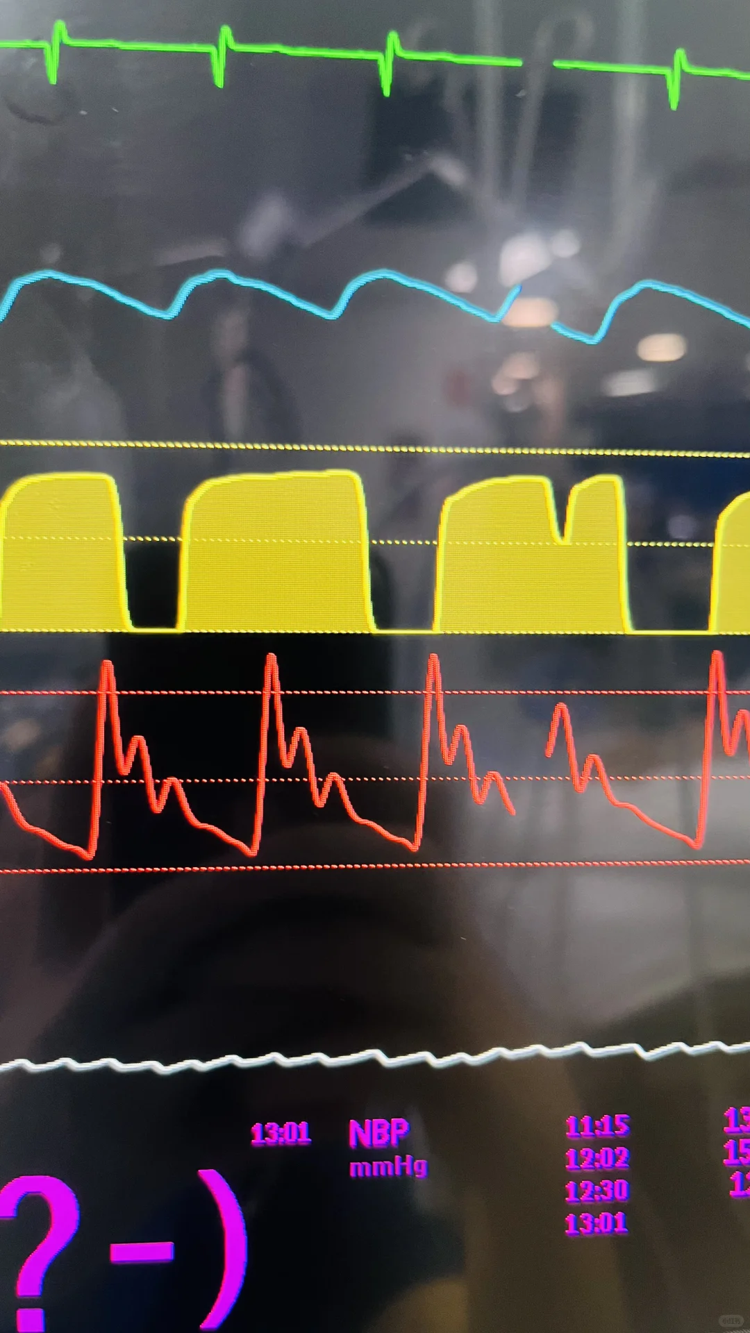 大家来看看这个IAL曲线