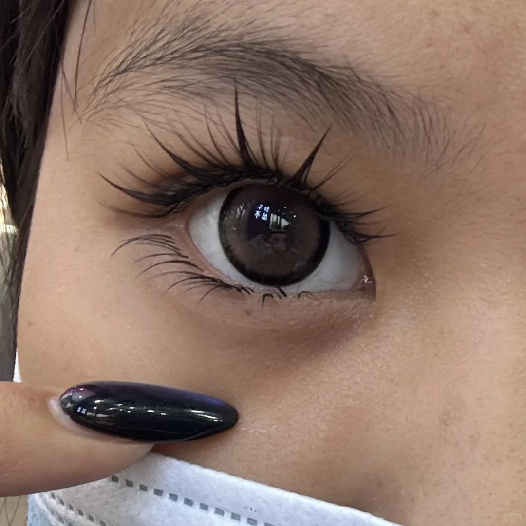 刚接完好漂亮 第二天变成这样 这样是正常的