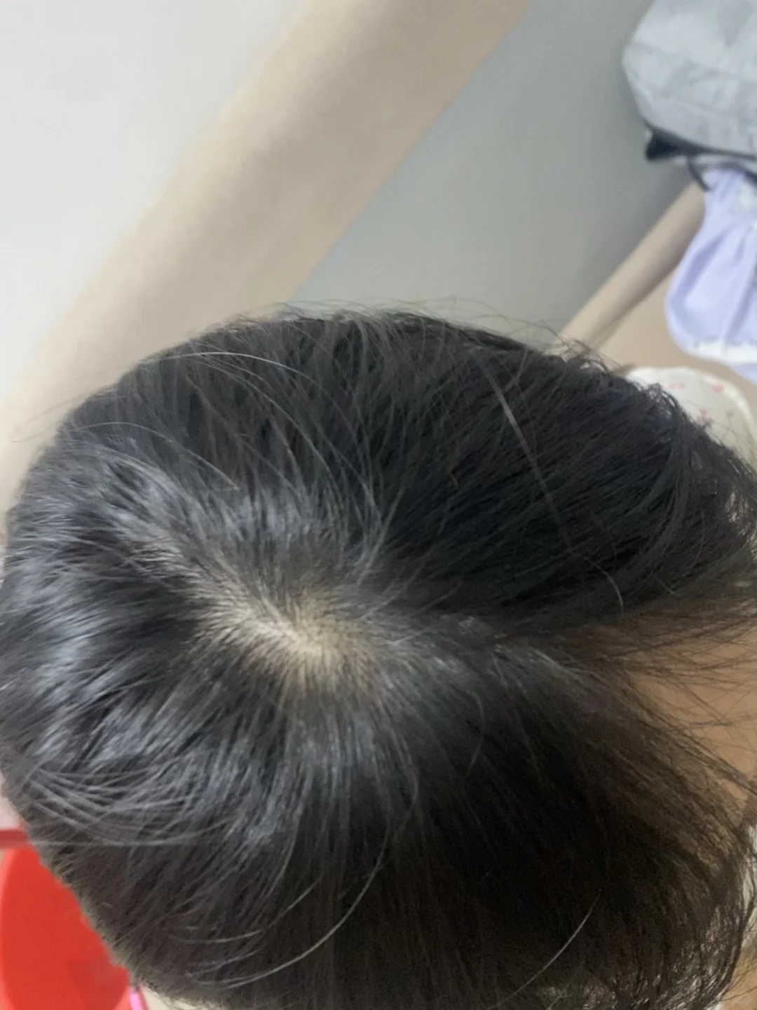 洗一次头发掉这么多正常吗