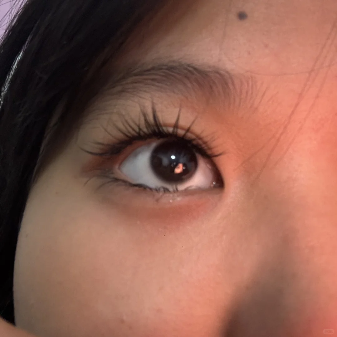 刚接完好漂亮 第二天变成这样 这样是正常的