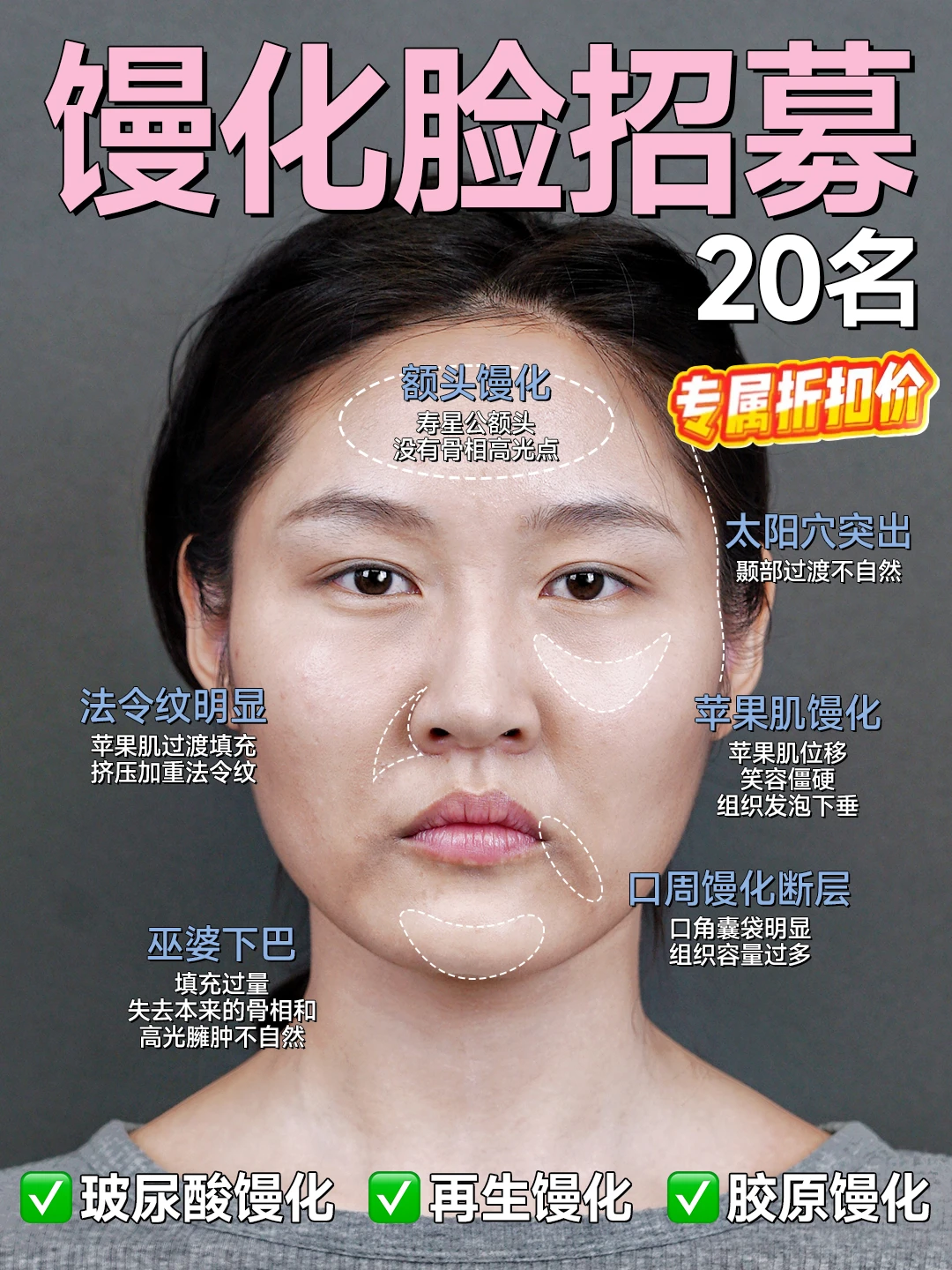 北京丨馒化脸爆改骨相轻薄脸招募啦！