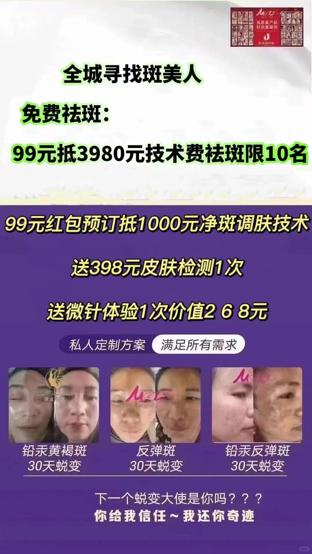 班美全城寻找蜕变美人✨