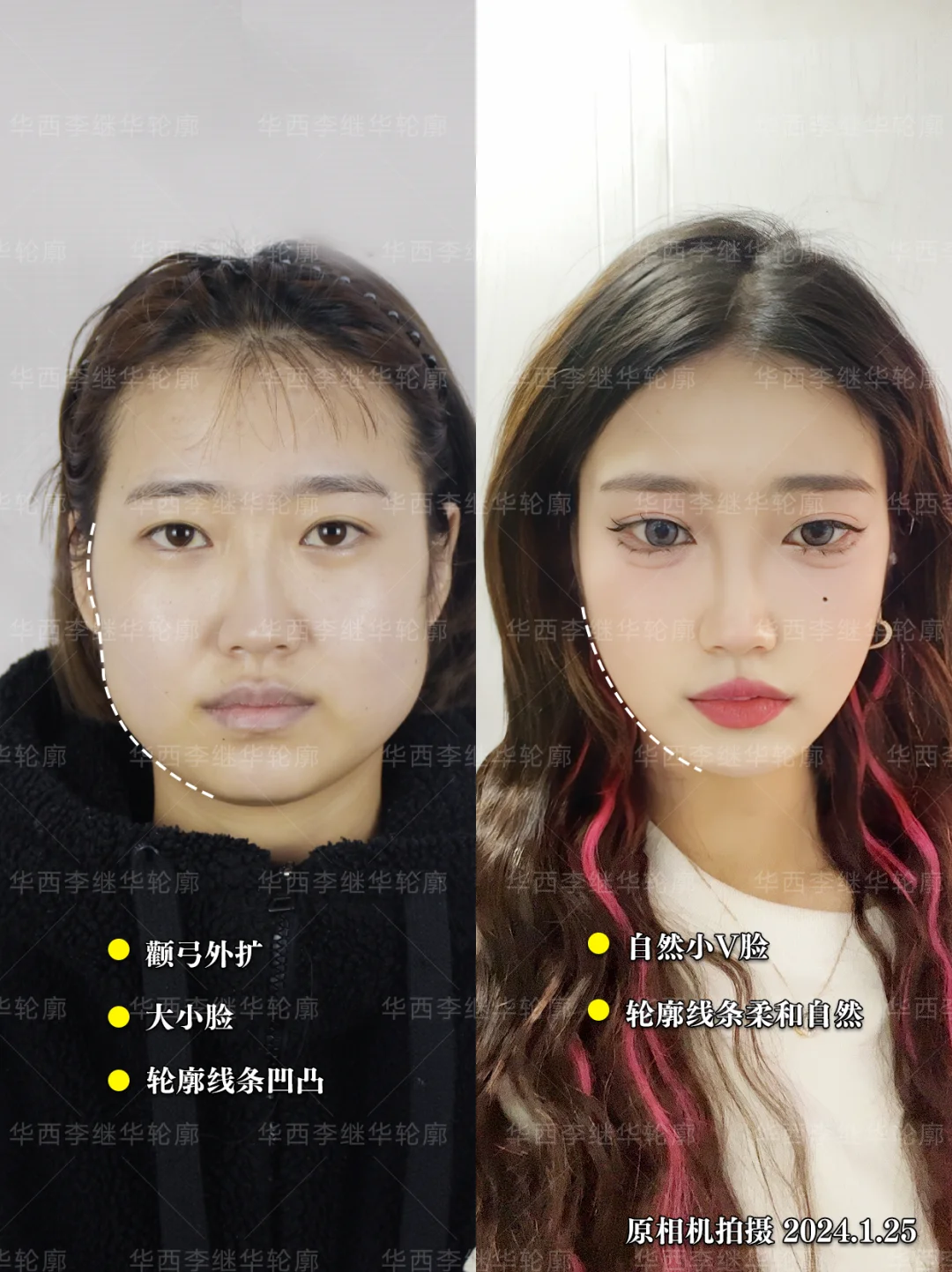 优化比例更协调，轮廓优势绝了～