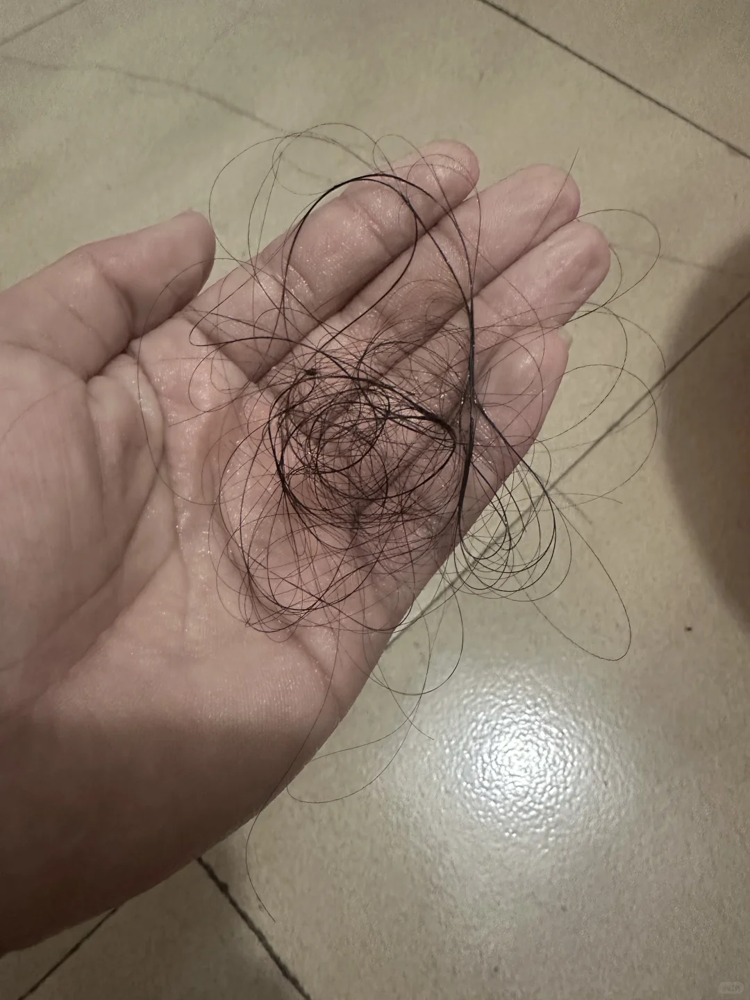 洗一次头发掉这么多正常吗