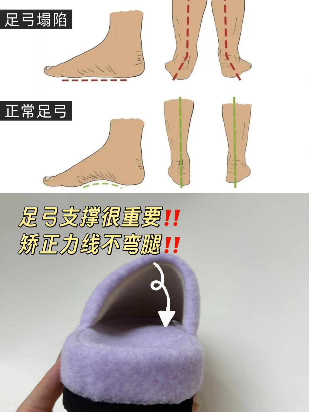 跟着卢昱晓穿直腿训练鞋！腿真的细了直了