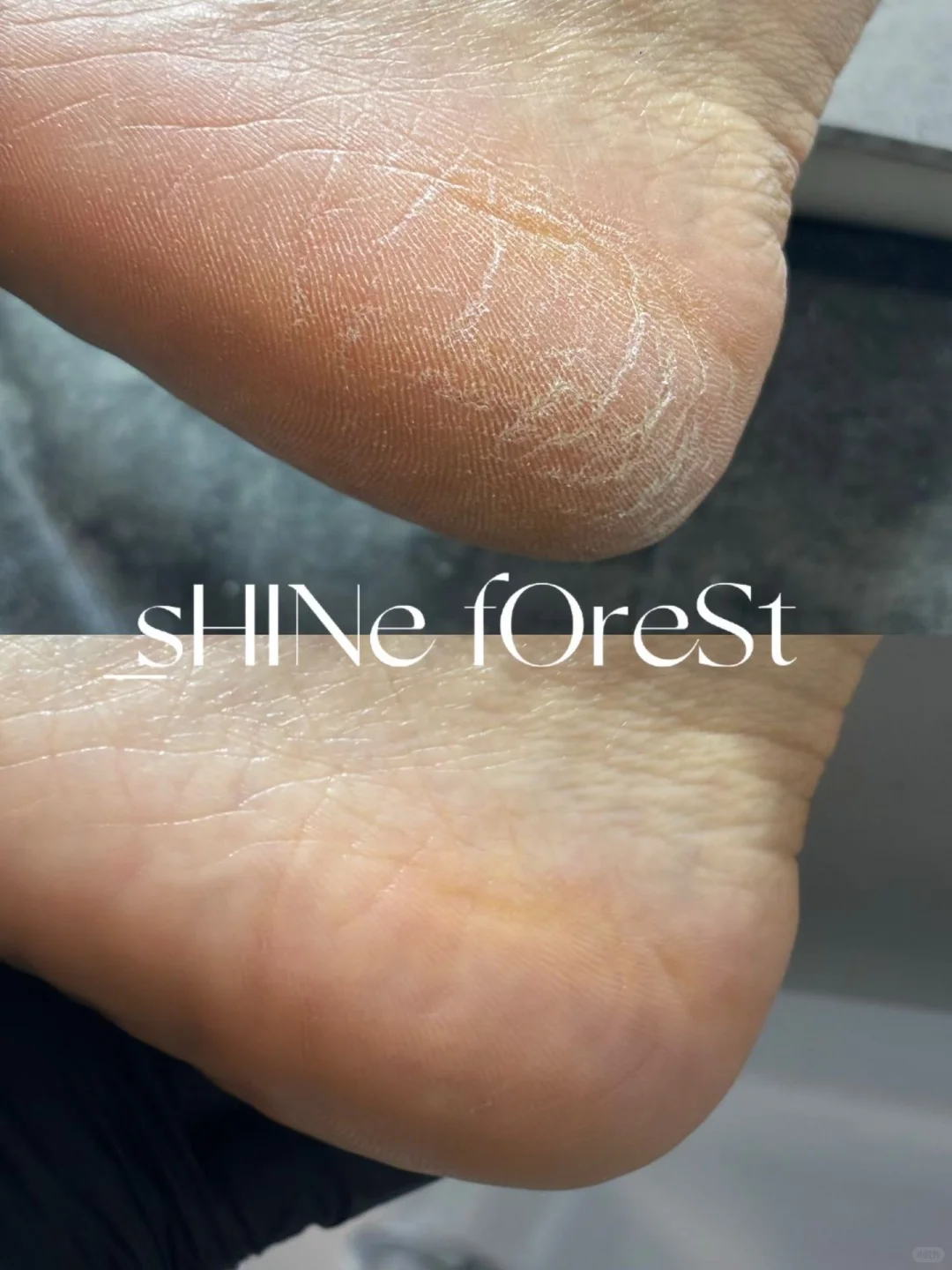 冬日的脚部护理是刚需啊！