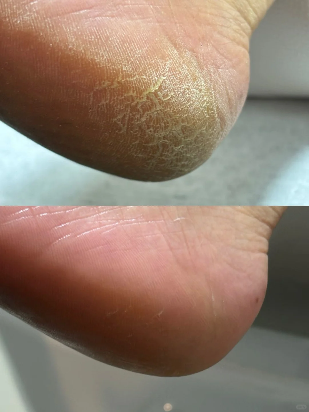 冬日的脚部护理是刚需啊！