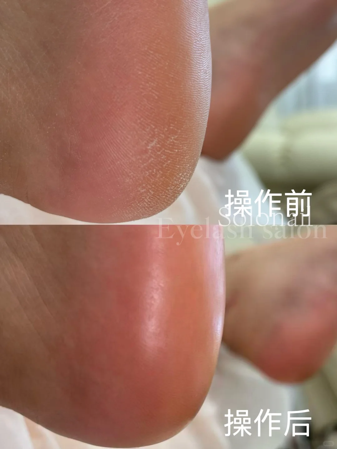 凤城-首家欧式修足