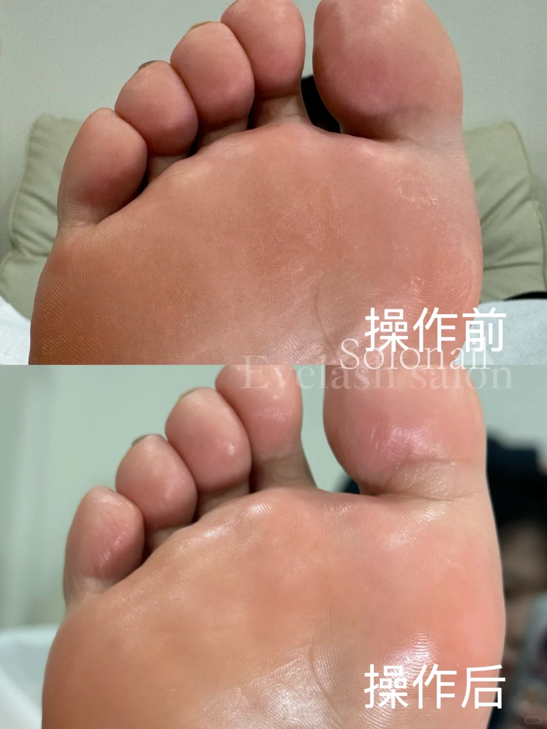 凤城-首家欧式修足