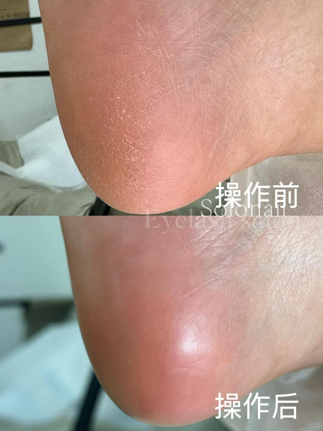 凤城-首家欧式修足