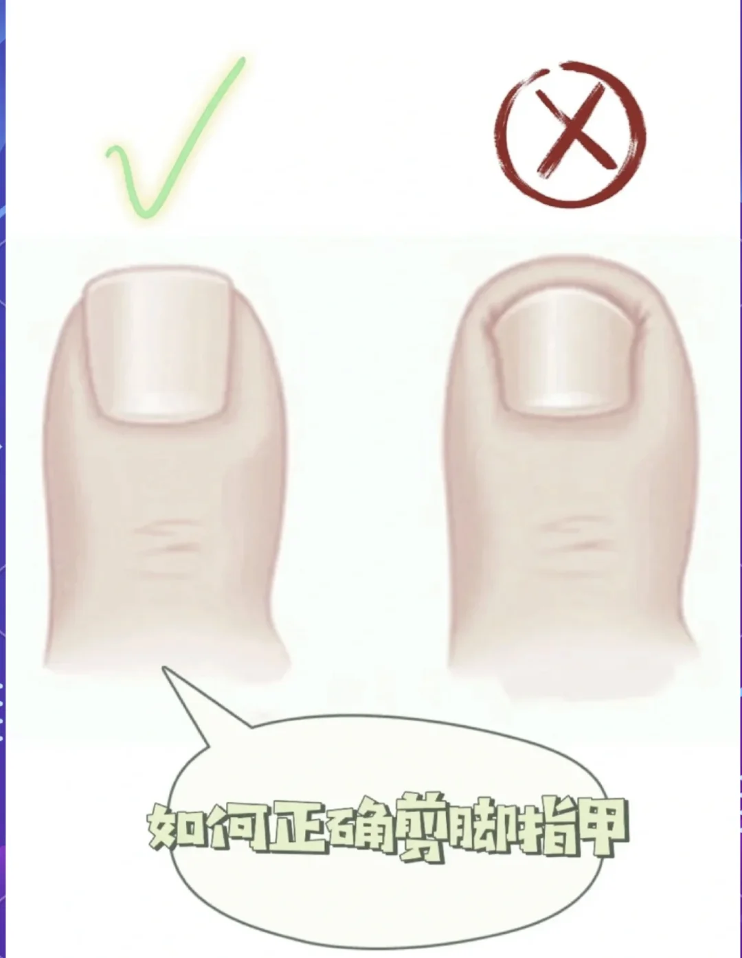 姐妹们❗❗一定要记住的脚部养护知识🦶！