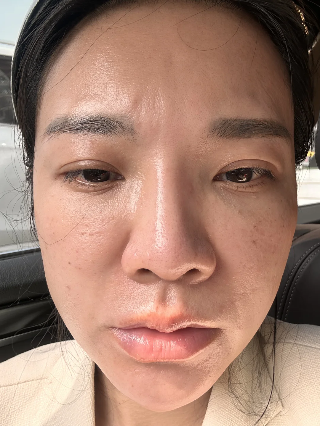 不想要的脸，正确护肤后，现在像开了磨皮😹