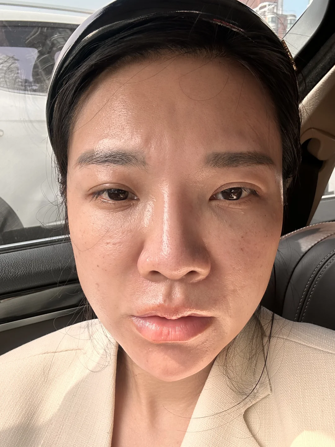 不想要的脸，正确护肤后，现在像开了磨皮😹