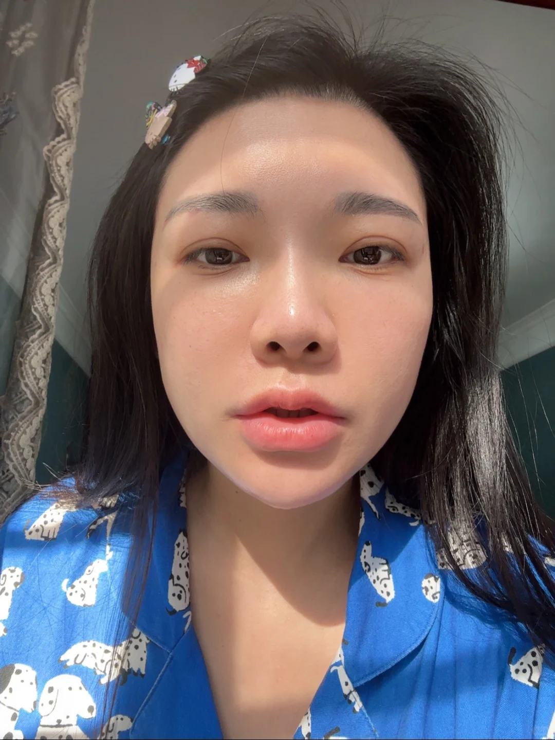 不想要的脸，正确护肤后，现在像开了磨皮😹