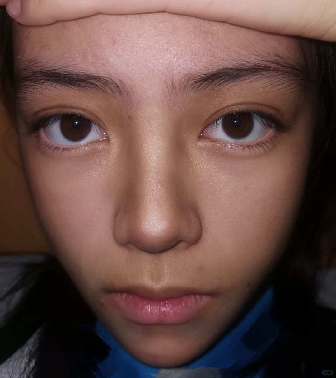 瑕疵让我变得更鲜活