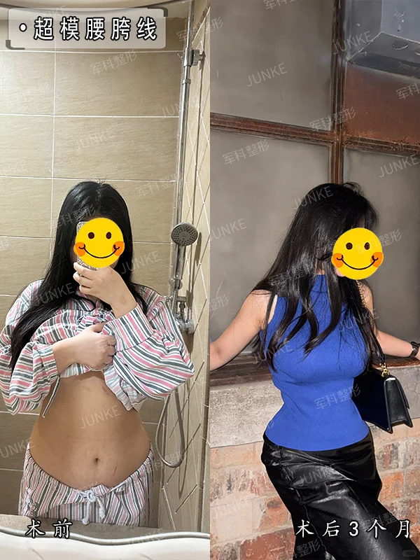 哇🌸小仙女们都喜欢的沙漏身材&曲线美♥