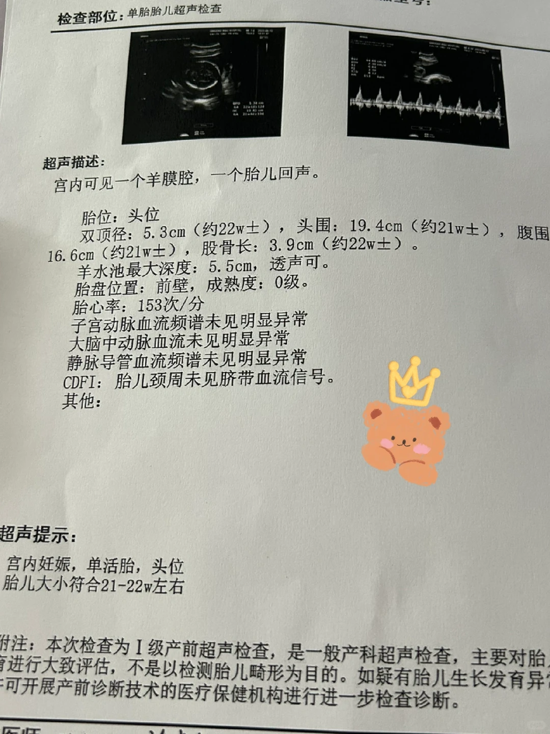 22周的小糯糯，医生夸长得很匀称！