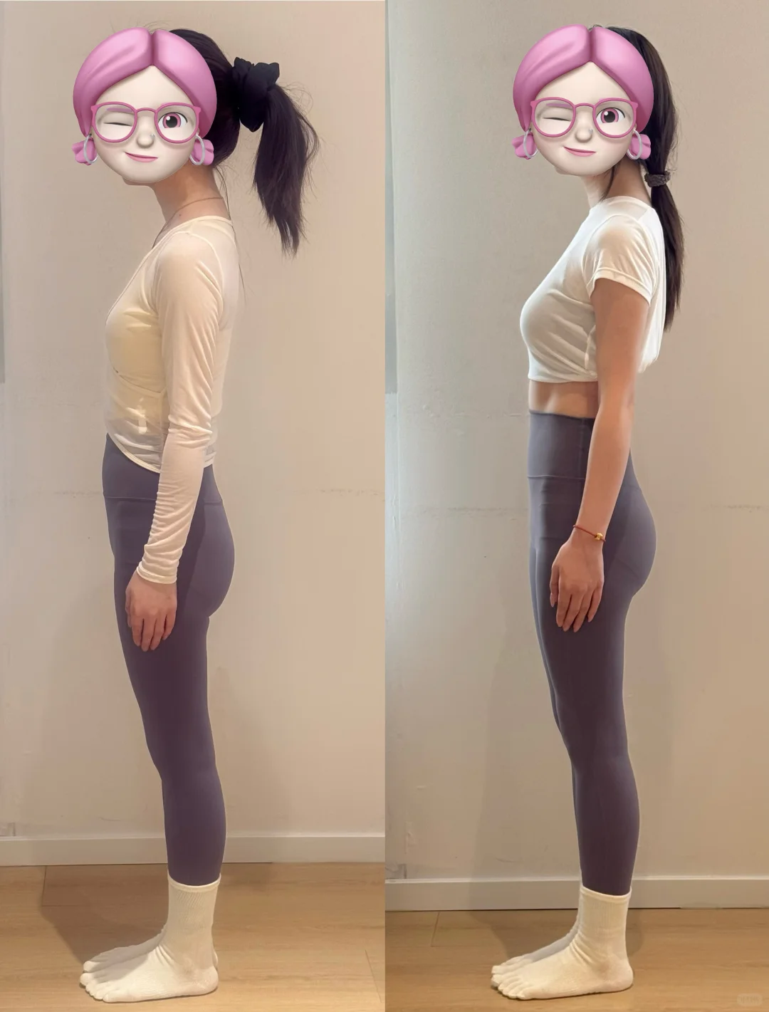 普拉提 体态调整 对比图