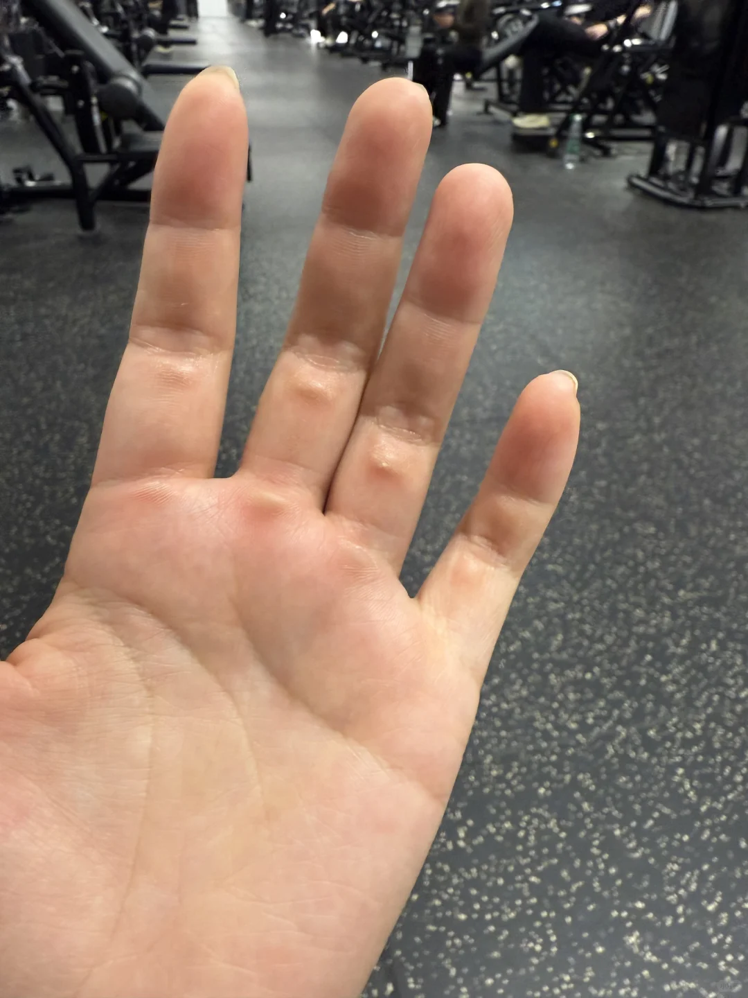 想看看有痕迹的手是怎么样的