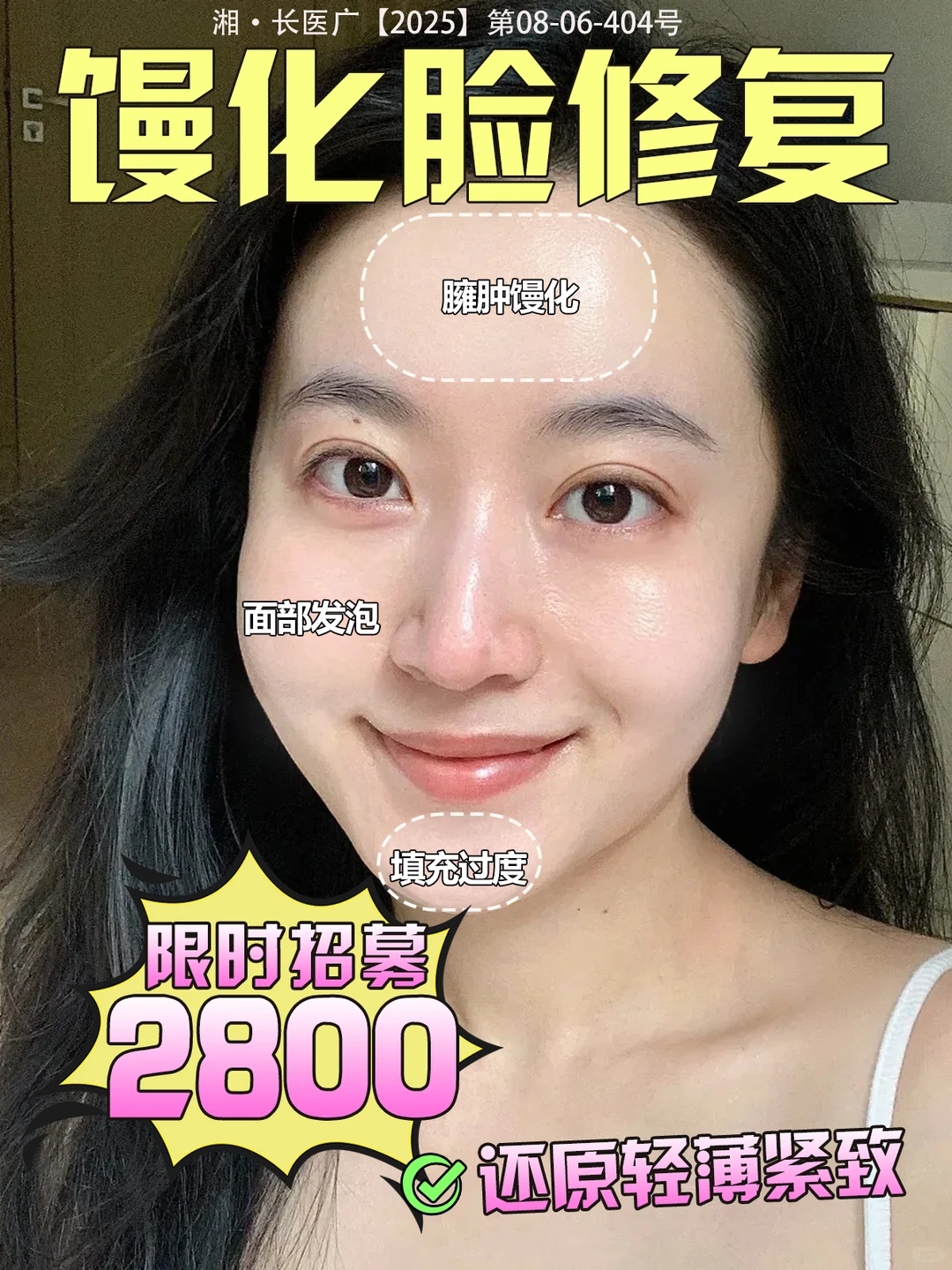馒化脸修复｜限时招募，还原轻薄紧致❗️
