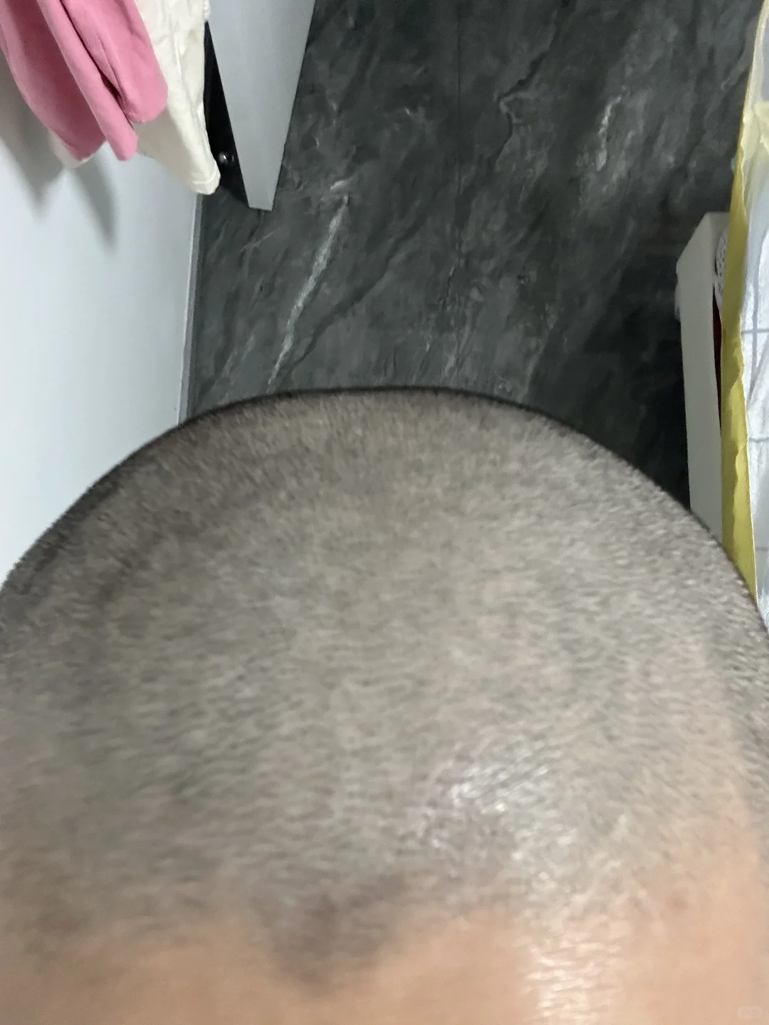 变成光头自然女了