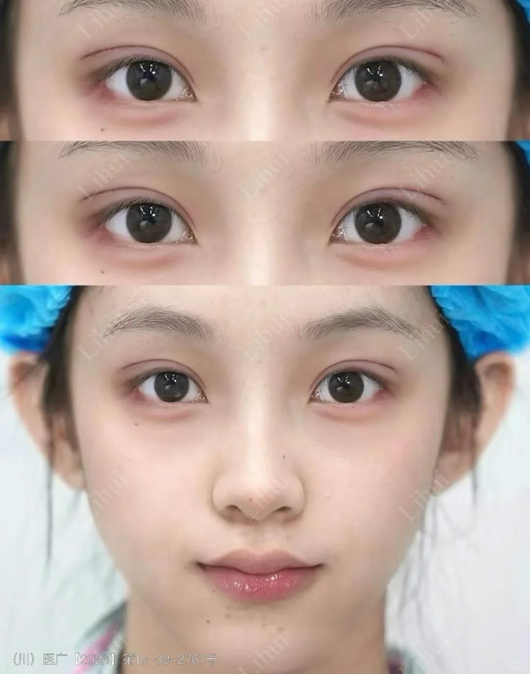 平扇眼尾的黄金5°｜自然妈生感+媚感双杀技