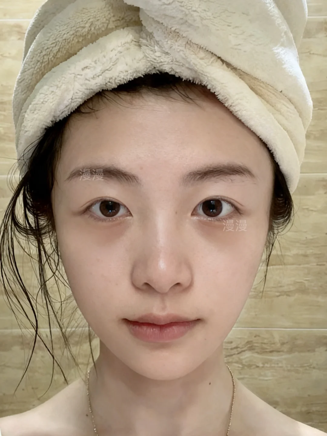 也是尝到了一针打飞眼尾的甜头