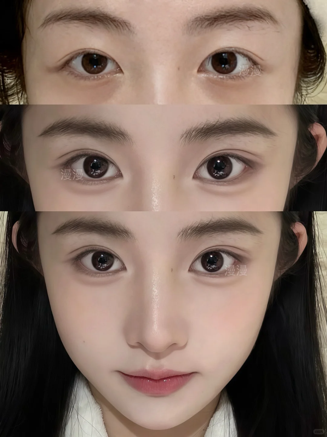 也是尝到了一针打飞眼尾的甜头